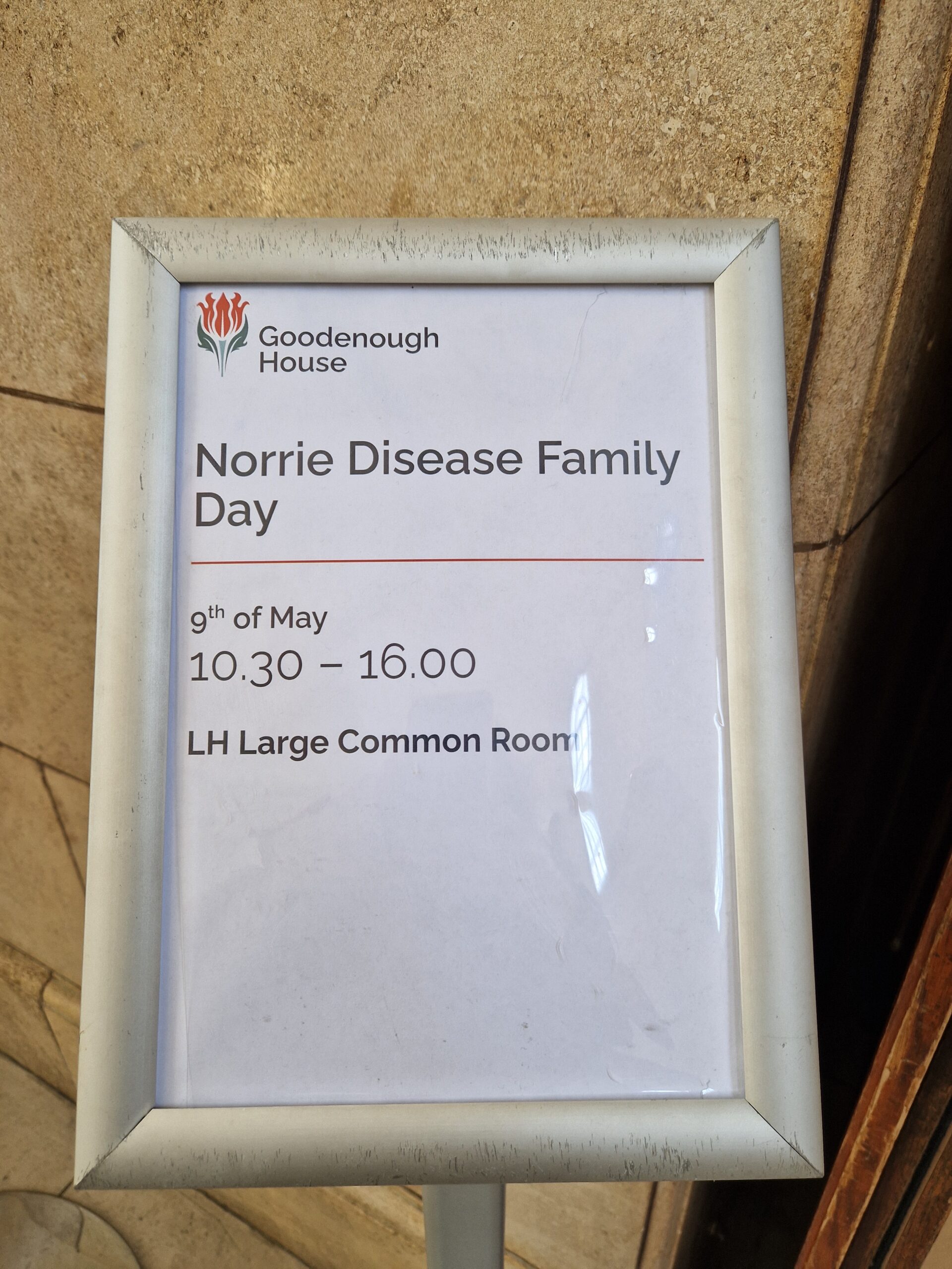 Norrie disease sign 1